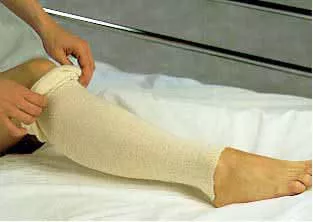 AlbaHealth Stockinette, 10/CS