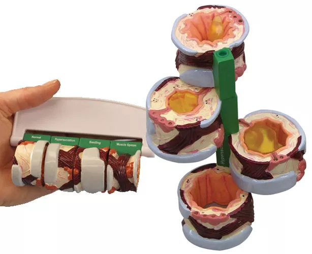 Bronchus Anatomy Model - 4 Piece