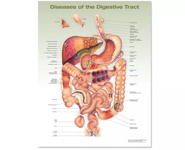 Diseases Of The Digestive System Anatomical Chart