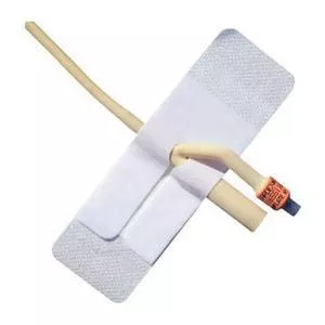 FoleyLoc Adhesive Foley Catheter Anchoring Device