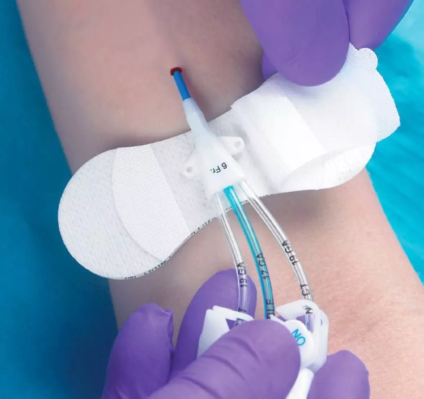 GRIP-LOK Catheter Securement, 100/BX
