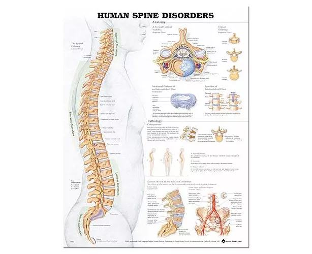 Human Spine Disorders Anatomical Chart