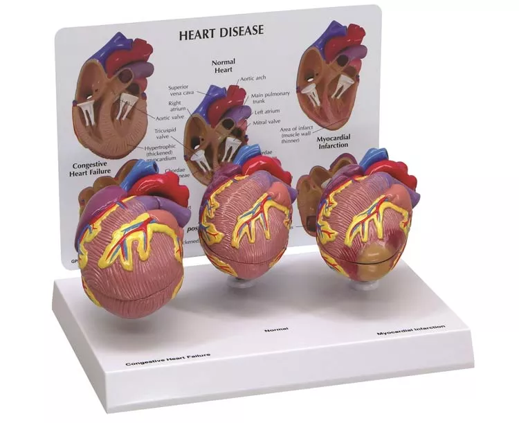 Mini Heart Anatomy Models Set - 3 Piece