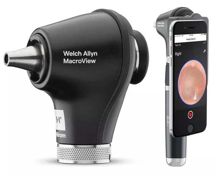 Welch Allyn MacroView Plus Otoscope